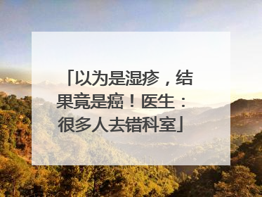 以为是湿疹，结果竟是癌！医生：很多人去错科室