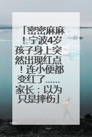 密密麻麻！宁波4岁孩子身上突然出现红点！连小便都变红了……家长：以为只是摔伤